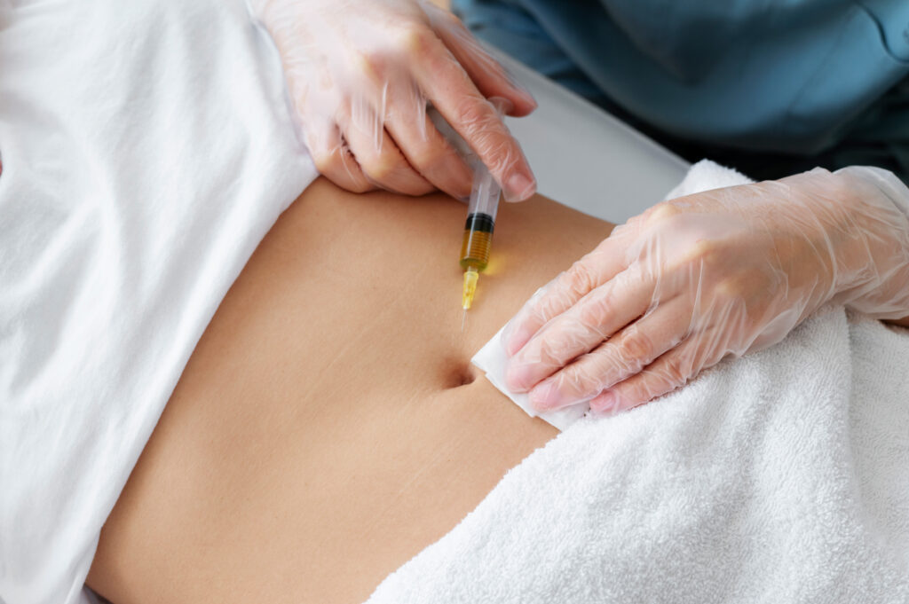 Tratamiento Mesoterapia Corporal